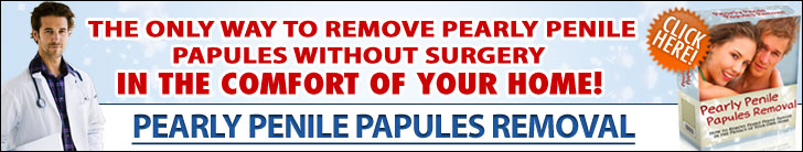 Penile Papules Removal