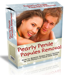 Pearly Penile Papules Removal Review