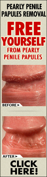 Pearly Penile Papules Removal